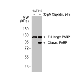 PARP antibody [HL1364] (GTX636804)
